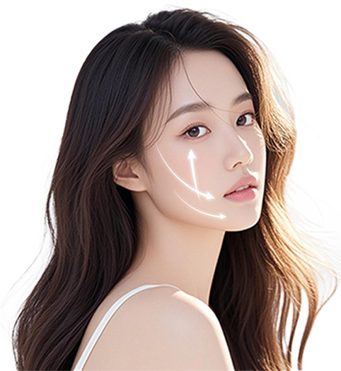 올리프팅